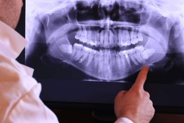 Best Emergency Treatment for Toothache in Manville, NJ